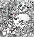 Behüllte Partikel des Rifttalfieber-Virus (Bunyaviridae) im Lumen des ER